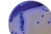 HardyCHROM Vibrio chromogenic plate